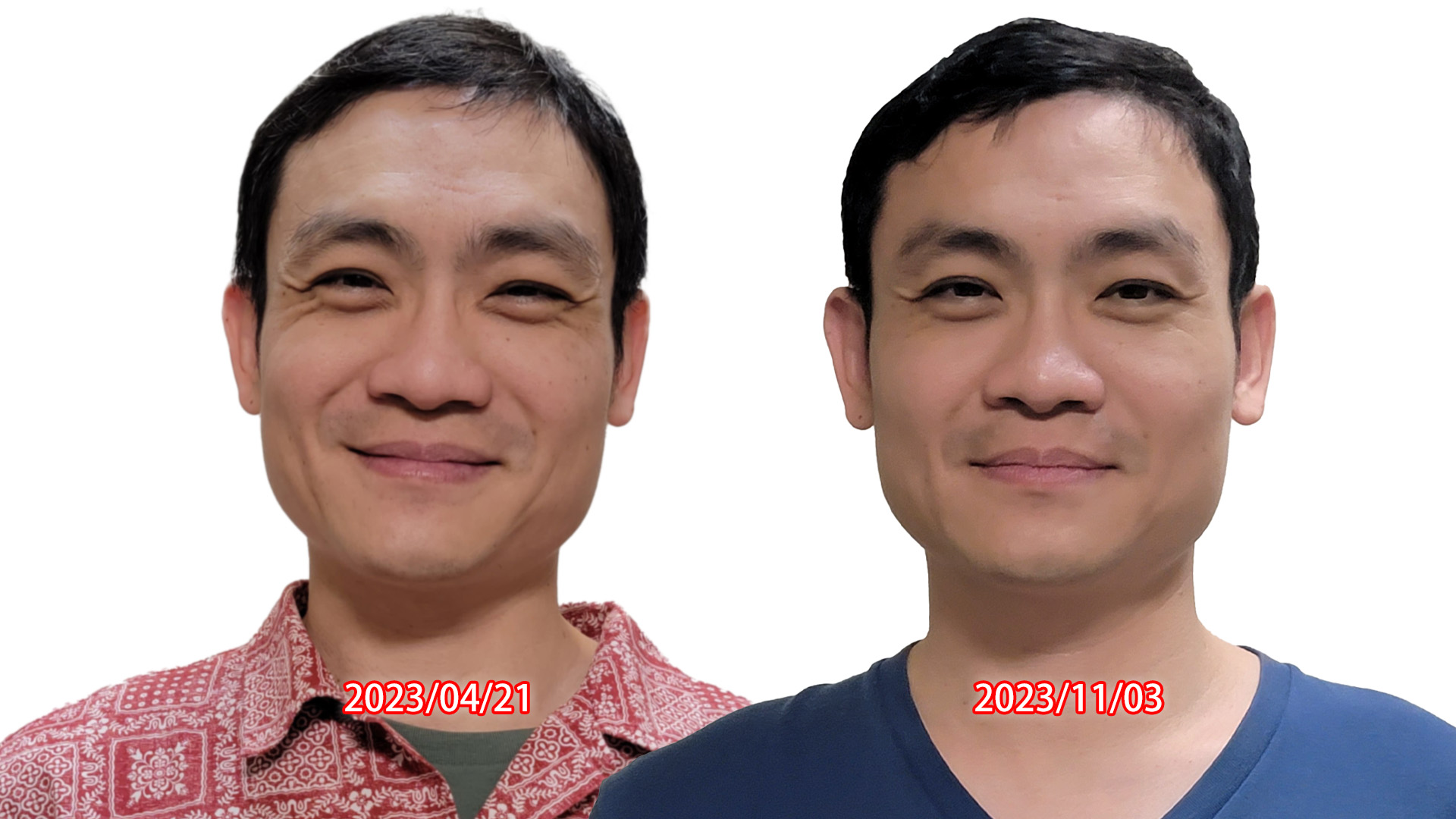 面提20次前後對照